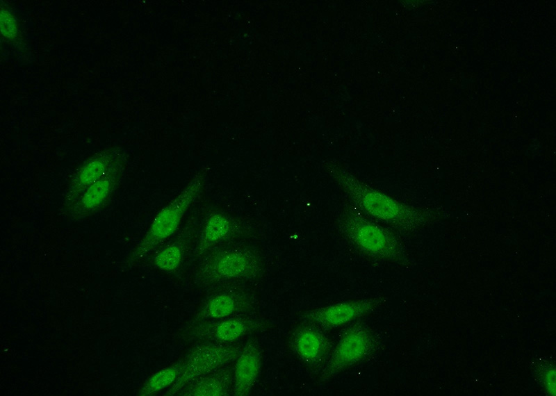 Immunofluorescent analysis of HepG2 cells using Catalog No:116944(ZNF101 Antibody) at dilution of 1:50 and Alexa Fluor 488-congugated AffiniPure Goat Anti-Rabbit IgG(H+L)