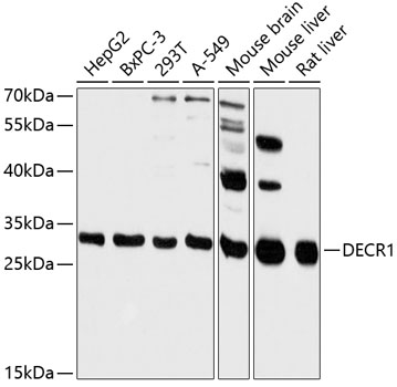 Western blot - DECR1 Polyclonal Antibody 