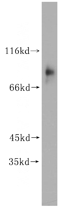 human placenta tissue were subjected to SDS PAGE followed by western blot with Catalog No:115888(TBX2 antibody) at dilution of 1:200
