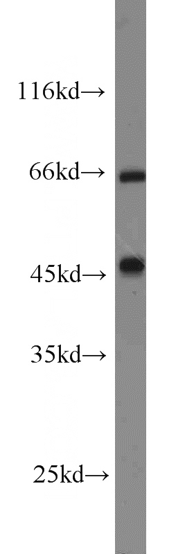 K-562 cells were subjected to SDS PAGE followed by western blot with Catalog No:109868(DARS2 antibody) at dilution of 1:800