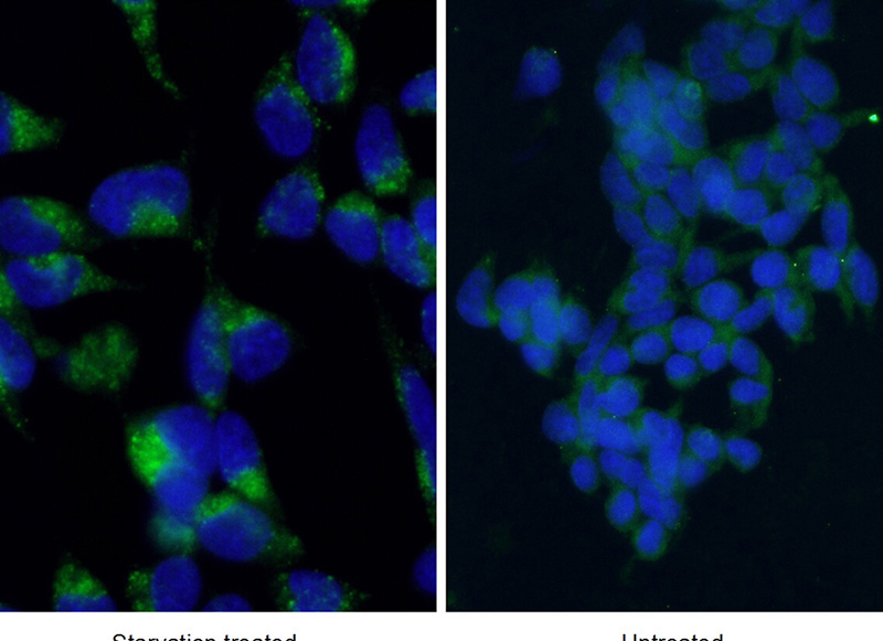 Immunofluorescent analysis of starvation treated HEK-293 cells using Catalog No:112163 (LC3 Antibody) at dilution of 1:50 and Alexa Fluor 488-congugated AffiniPure Goat Anti-Rabbit IgG(H+L). Cells were fixed with ethanol at -20 °C. 20 mM chloroquine was used to block the autophagy flux.