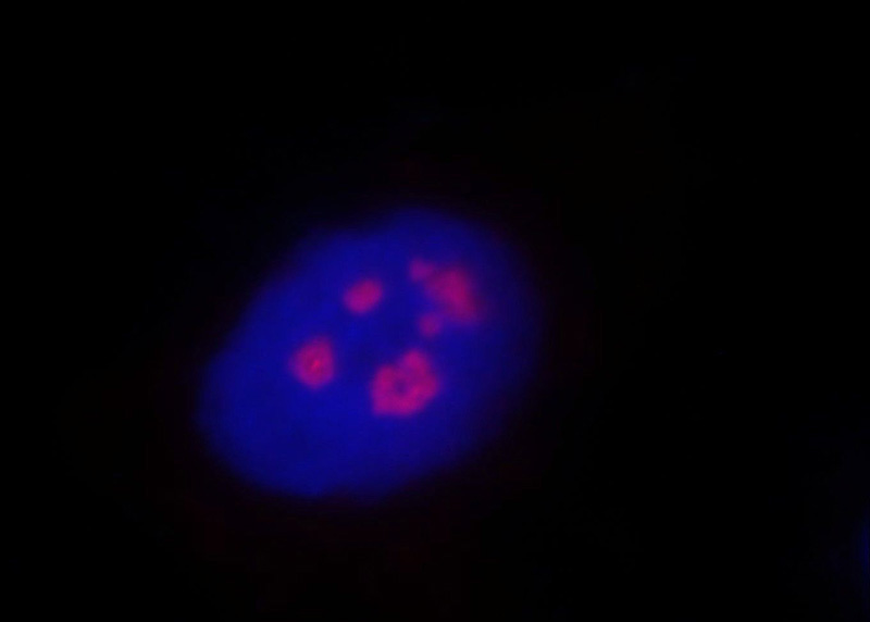 Immunofluorescent analysis of MCF-7 cells, using REX4 antibody Catalog No:114622 at 1:25 dilution and Rhodamine-labeled goat anti-rabbit IgG (red). Blue pseudocolor = DAPI (fluorescent DNA dye).