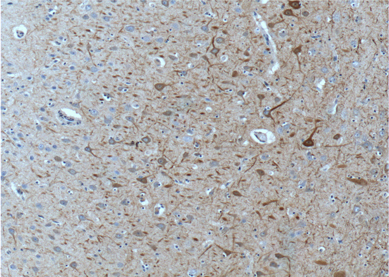 Immunohistochemistry of paraffin-embedded human brain tissue slide using Catalog No:113163(NEFM-Specific Antibody) at dilution of 1:200 (under 10x lens).