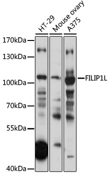 Western blot - FILIP1L Polyclonal Antibody 