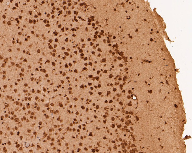 Fig7: Immunohistochemical analysis of paraffin-embedded mouse brain tissue using anti-RBPMS antibody. The section was pre-treated using heat mediated antigen retrieval with sodium citrate buffer (pH 6.0) for 20 minutes. The tissues were blocked in 5% BSA