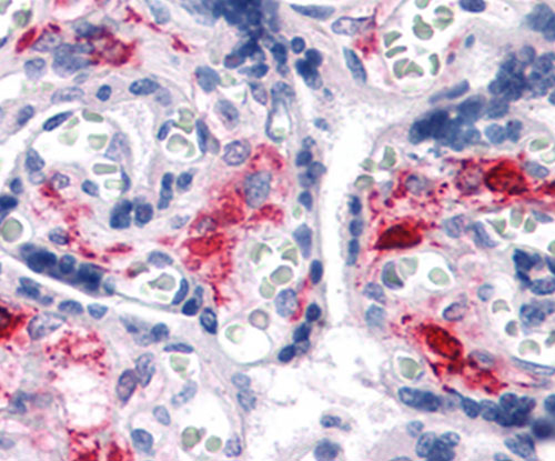 Fig2: Immunohistochemical analysis of paraffin-embedded human liver tissue using anti-NKX3A antibody. Counter stained with hematoxylin.