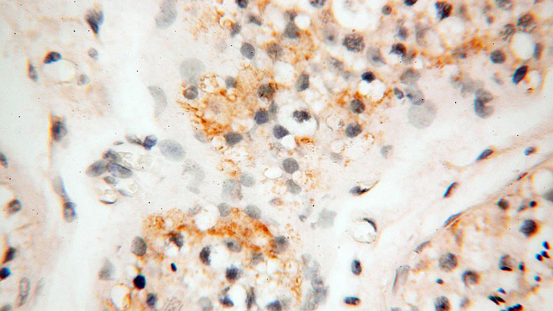 Immunohistochemical of paraffin-embedded human testis using Catalog No:116309(TRIM29 antibody) at dilution of 1:100 (under 40x lens)