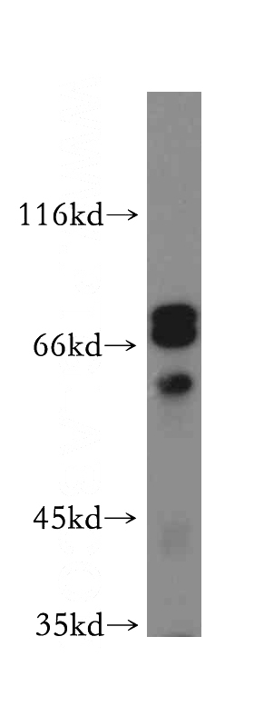 mouse brain tissue were subjected to SDS PAGE followed by western blot with Catalog No:116842(WASF4-Specific antibody) at dilution of 1:300