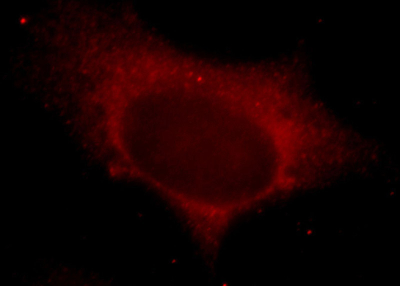 Immunofluorescent analysis of Hela cells, using LIMS1 antibody Catalog No:112230 at 1:25 dilution and Rhodamine-labeled goat anti-rabbit IgG (red).