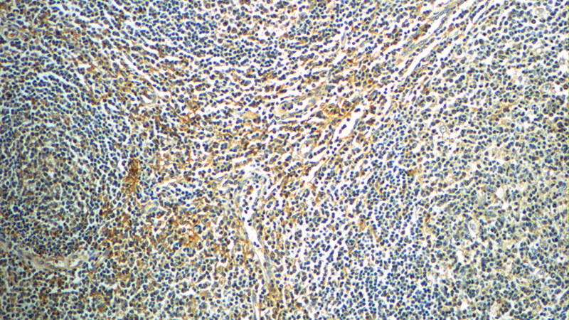Immunohistochemistry of paraffin-embedded human tonsillitis slide using Catalog No:115226(SIGLEC7 Antibody) at dilution of 1:50