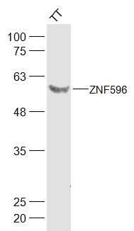 Fig1: Sample:; TT(Human) Cell Lysate at 30 ug; Primary: Anti-ZNF596 at 1/300 dilution; Secondary: IRDye800CW Goat Anti-Rabbit IgG at 1/20000 dilution; Predicted band size: 55 kD; Observed band size: 55 kD