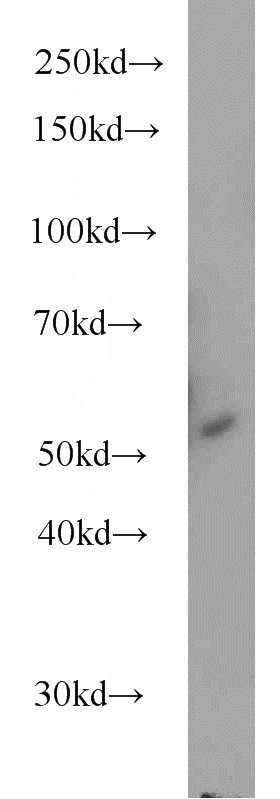 HeLa cells were subjected to SDS PAGE followed by western blot with Catalog No:115096(SCG3 antibody) at dilution of 1:500