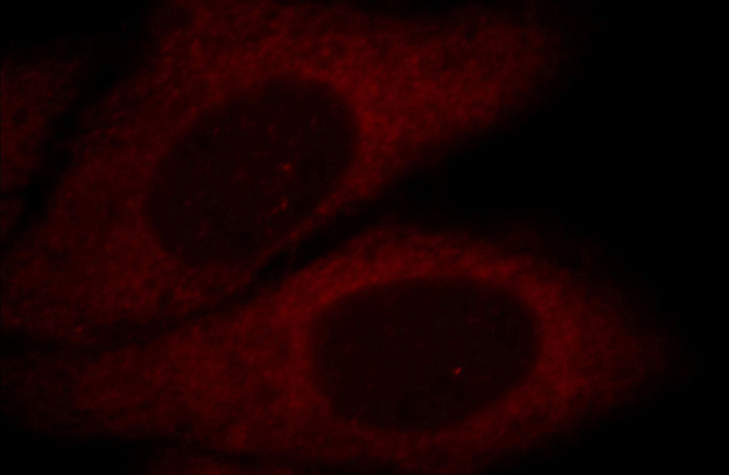 Immunofluorescent analysis of HepG2 cells, using ALDoc antibody Catalog No:107978 at 1:25 dilution and Rhodamine-labeled goat anti-rabbit IgG (red).
