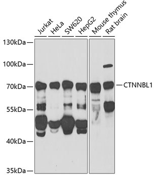 Western blot - CTNNBL1 Polyclonal Antibody 