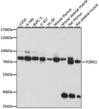 Western blot - TCIRG1 Polyclonal Antibody 