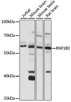 Western blot - RNF180 Polyclonal Antibody 