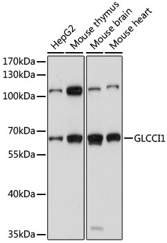 Western blot - GLCCI1 Polyclonal Antibody 