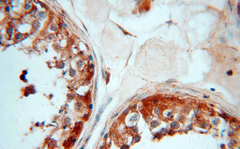 Immunohistochemical of paraffin-embedded human testis using Catalog No:108311(ATP6V1E1 antibody) at dilution of 1:100 (under 40x lens)