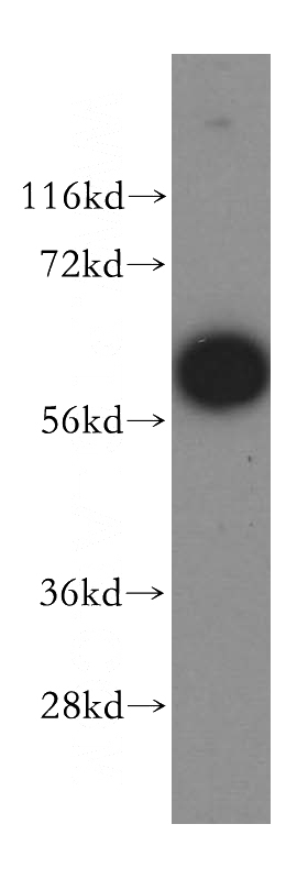 MCF7 cells were subjected to SDS PAGE followed by western blot with Catalog No:112385(MAGEB18 antibody) at dilution of 1:500