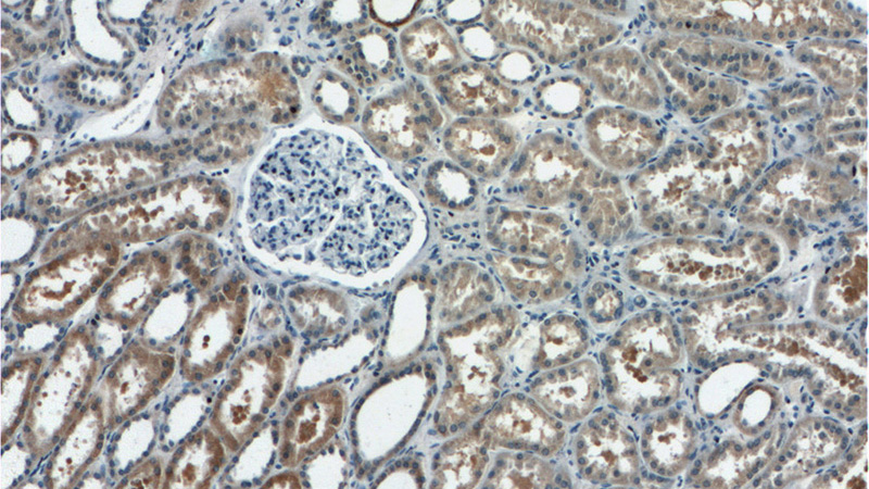 Immunohistochemistry of paraffin-embedded human kidney tissue slide using Catalog No:114615(RBM46 Antibody) at dilution of 1:50 (under 10x lens)