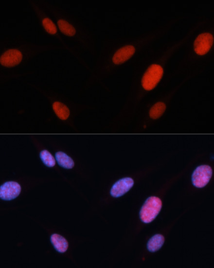 Immunofluorescence - FOSL2 Polyclonal Antibody 