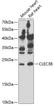 Western blot - CLEC3B Polyclonal Antibody 
