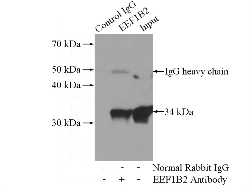 IP Result of anti-EEF1B2 (IP:Catalog No:110313, 4ug; Detection:Catalog No:110313 1:500) with Jurkat cells lysate 2400ug.