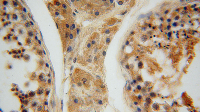 Immunohistochemical of paraffin-embedded human testis using Catalog No:111353(HIP14; ZDHHC17 antibody) at dilution of 1:50 (under 40x lens)