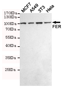 Western blot detection of FER in MCF7,A549,3T3 and Hela cell lysates using FER mouse mAb (1:500 diluted).Predicted band size:95KDa.Observed band size:95KDa.