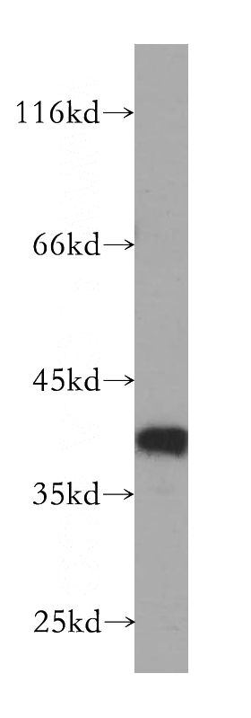 HeLa cells were subjected to SDS PAGE followed by western blot with Catalog No:115871(TBCC antibody) at dilution of 1:500