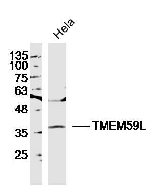 Fig1: Sample: Hela Cell(Human)Lysate at 30 ug; Primary: Anti-TMEM59L at 1/300 dilution; Secondary: IRDye800CW Goat Anti-Rabbit IgG at 1/20000 dilution; Predicted band size: 35kD; Observed band size: 37kD