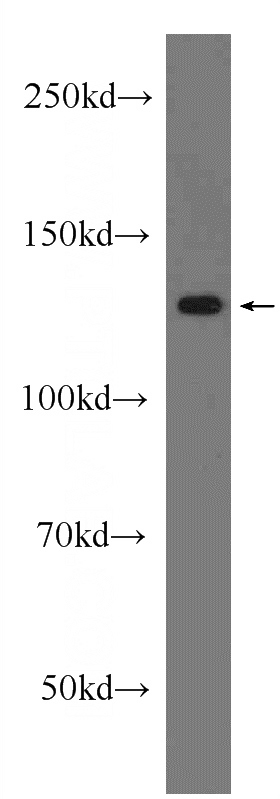 HeLa cells were subjected to SDS PAGE followed by western blot with Catalog No:115241(SIRT1 Antibody) at dilution of 1:800