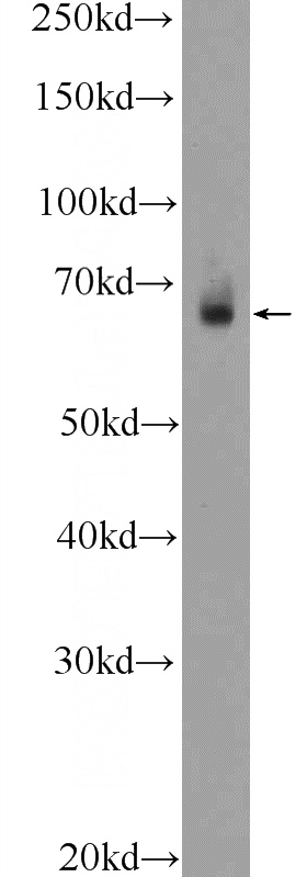 mouse colon tissue were subjected to SDS PAGE followed by western blot with Catalog No:115932(TEAD2 Antibody) at dilution of 1:300