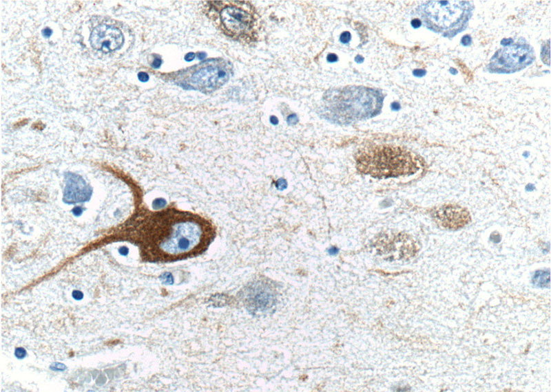 Immunohistochemistry of paraffin-embedded human brain tissue slide using Catalog No:113149(NEFH Antibody) at dilution of 1:200 (under 40x lens)