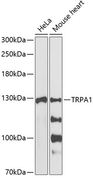 Western blot - TRPA1 Polyclonal Antibody 