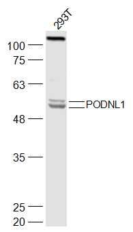 Fig1: Sample:; 293T(Human) Cell Lysate at 30 ug; Primary: Anti-PODNL1 at 1/300 dilution; Secondary: IRDye800CW Goat Anti-Rabbit IgG at 1/20000 dilution; Predicted band size: 54 kD; Observed band size: 54/56 kD
