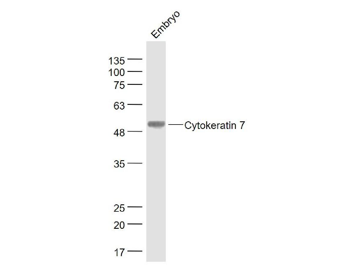 Fig5: Sample:; Embryo (Mouse) Lysate at 40 ug; Primary: Anti- Cytokeratin 7 at 1/1000 dilution; Secondary: IRDye800CW Goat Anti-Rabbit IgG at 1/20000 dilution; Predicted band size: 54 kD; Observed band size: 54 kD