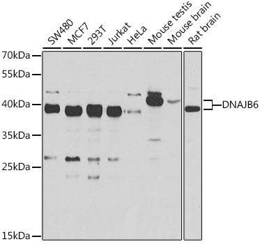 Western blot - DNAJB6 Polyclonal Antibody 