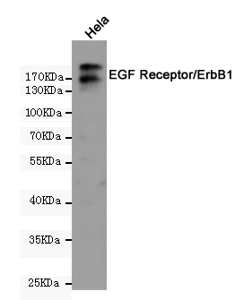 Western blot detection of EGF Receptor/ErbB1 in Hela cell lysates using EGF Receptor/ErbB1 (5E9) Mouse mAb(1:1000 diluted).Predicted band size:170KDa.Observed band size:175KDa.