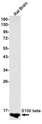 Western blot detection of S100 beta in Rat Brain lysates using S100 beta Rabbit pAb(1:500 diluted).Predicted band size:11kDa.Observed band size:11kDa.