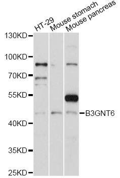 Western blot - B3GNT6 Polyclonal Antibody 