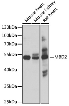 Western blot - MBD2 Polyclonal Antibody 