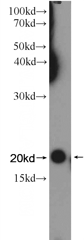 K-562 cells were subjected to SDS PAGE followed by western blot with Catalog No:113068(NDUFAF4 Antibody) at dilution of 1:1200