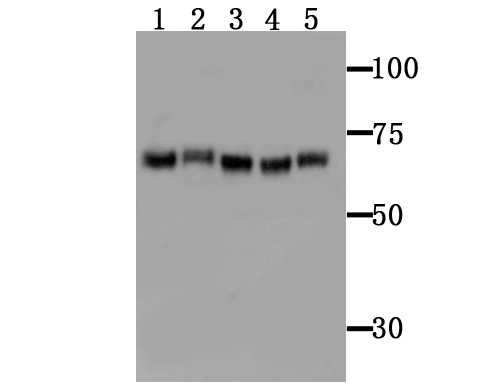 Fig1: Western blot analysis of TGM6 on different tissue lysates using anti-TGM6 antibody at 1/100 dilution.; Positive control:; Lane 1 : Mouse brain; Lane 2 : Mouse brain; Lane 3 : Mouse spleen; Lane 4 : Mouse spleen; Lane 5 : Mouse testis