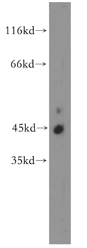 K-562 cells were subjected to SDS PAGE followed by western blot with Catalog No:109107(CDC42EP4 antibody) at dilution of 1:1000