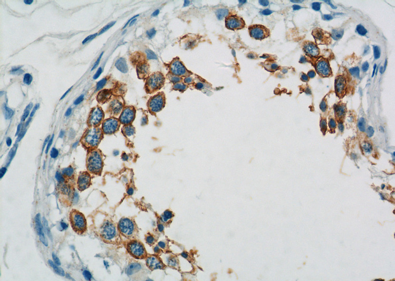 Immunohistochemistry of paraffin-embedded human testis tissue slide using Catalog No:115955(TEX101 Antibody) at dilution of 1:50 (under 40x lens)