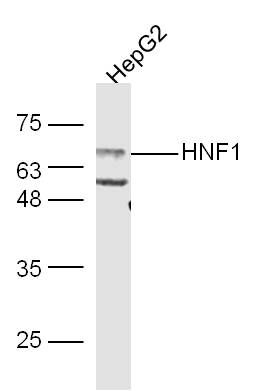 Fig3: Sample:; HepG2 Cell (Human) Lysate at 30 ug; Primary: Anti-HNF1 (Bs-1405R) at 1/300 dilution; Secondary: IRDye800CW Goat Anti-Rabbit IgG at 1/20000 dilution; Predicted band size: 67 kD; Observed band size: 67 kD