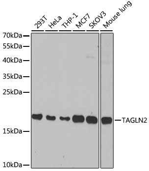 Western blot - TAGLN2 Polyclonal Antibody 