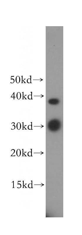 HEK-293 cells were subjected to SDS PAGE followed by western blot with Catalog No:116566(ULBP1 antibody) at dilution of 1:300