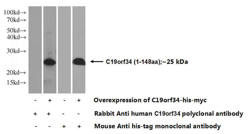 Transfected HEK-293 cells were subjected to SDS PAGE followed by western blot with Catalog No:108620(C19orf34 Antibody) at dilution of 1:500